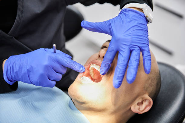 Best Knocked-Out Tooth (Avulsed Tooth) Treatment in Bannockburn, IL