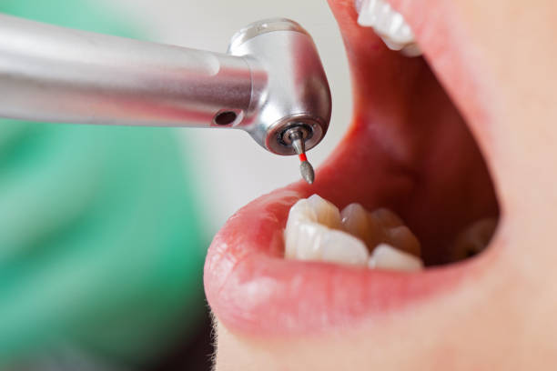 Best Emergency Denture Repair in Bannockburn, IL